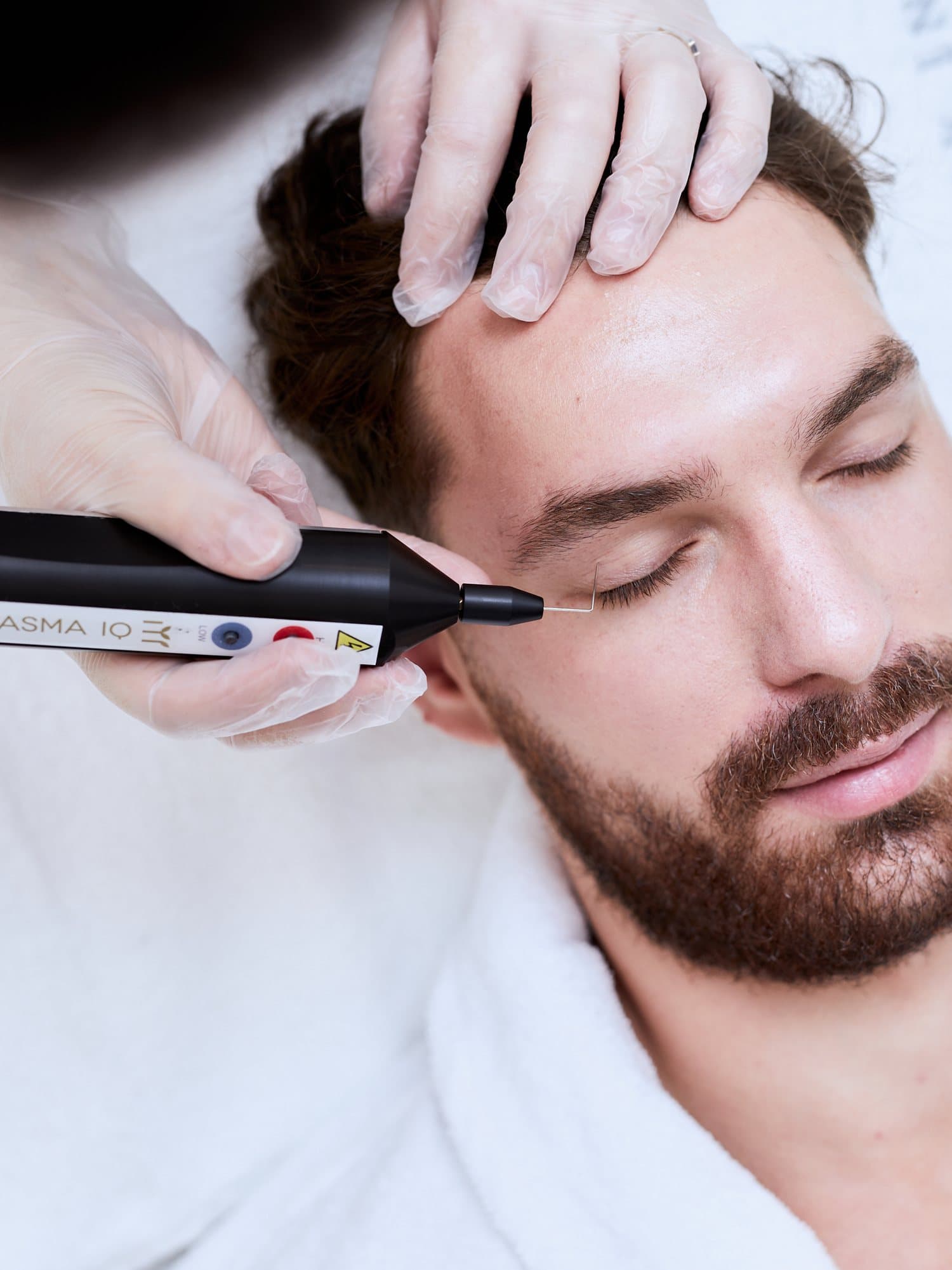 Plazma (Plasma IQ — plasma pen) — zabieg w J'adore Instytut — Zabieg plazmą