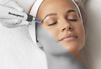 FRACTIONAL AND DERMAROLLER MESOTHERAPY
