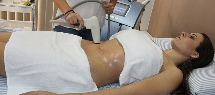 anti-cellulite treatments