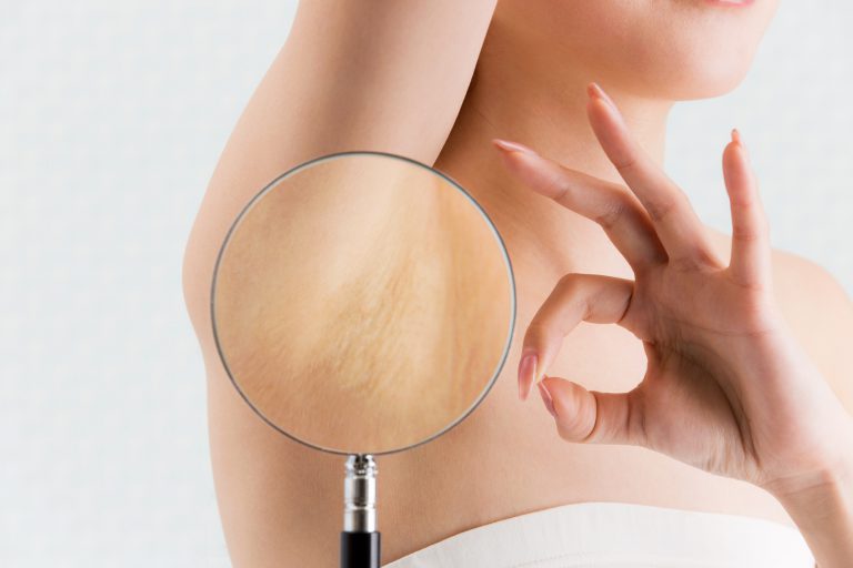 Laser epilation of light hair – is it possible?